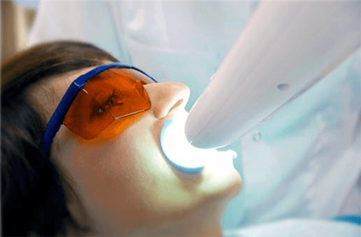 Understanding the Causes of Teeth Sensitivity Romford