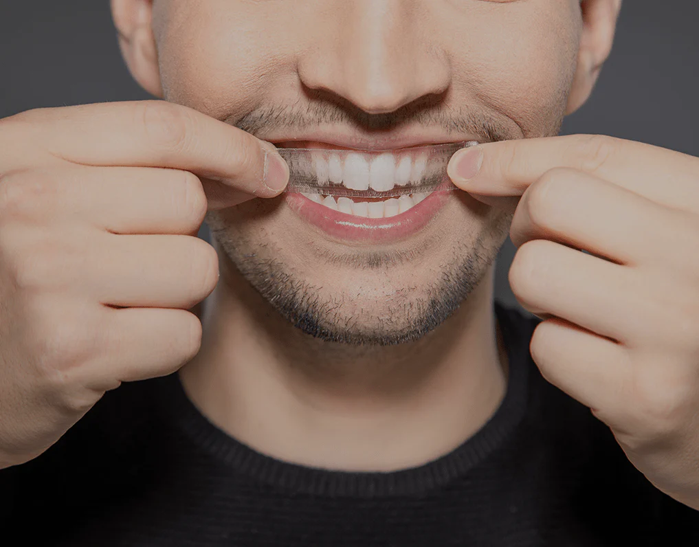 How Are Invisible Aligners Changing Orthodontic Treatments Romford?