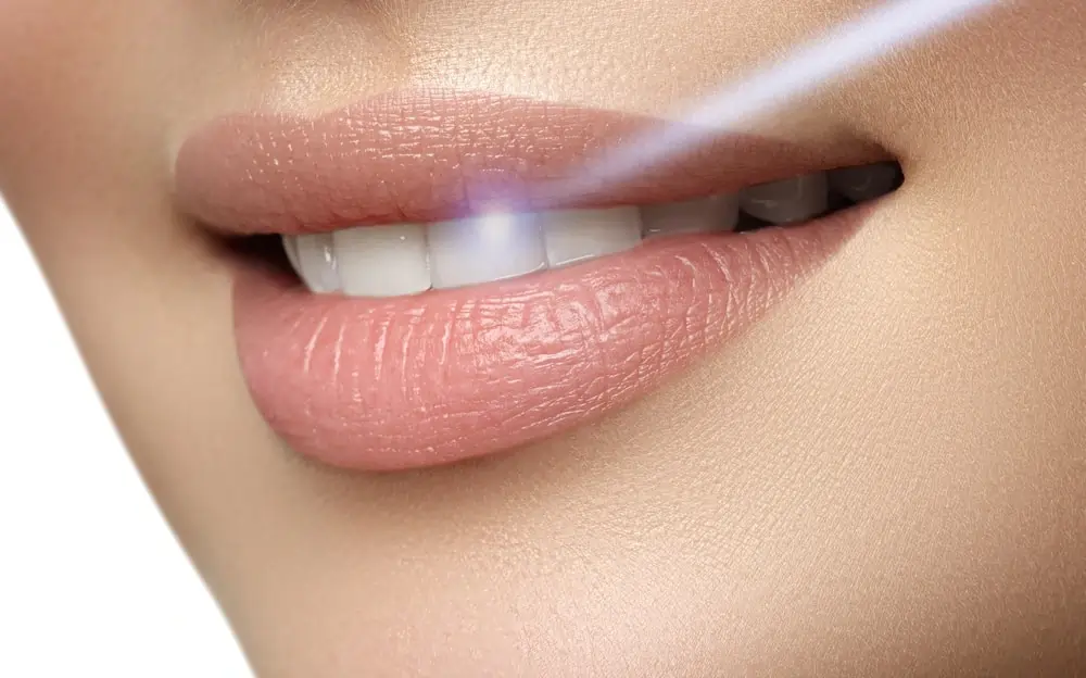 How Different Cultures Achieve Naturally Brighter Smiles Romford