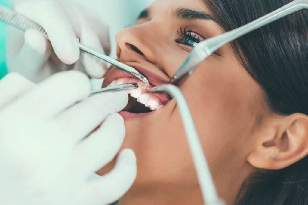 Braces Are Just for Kids – Myth or Reality Romford