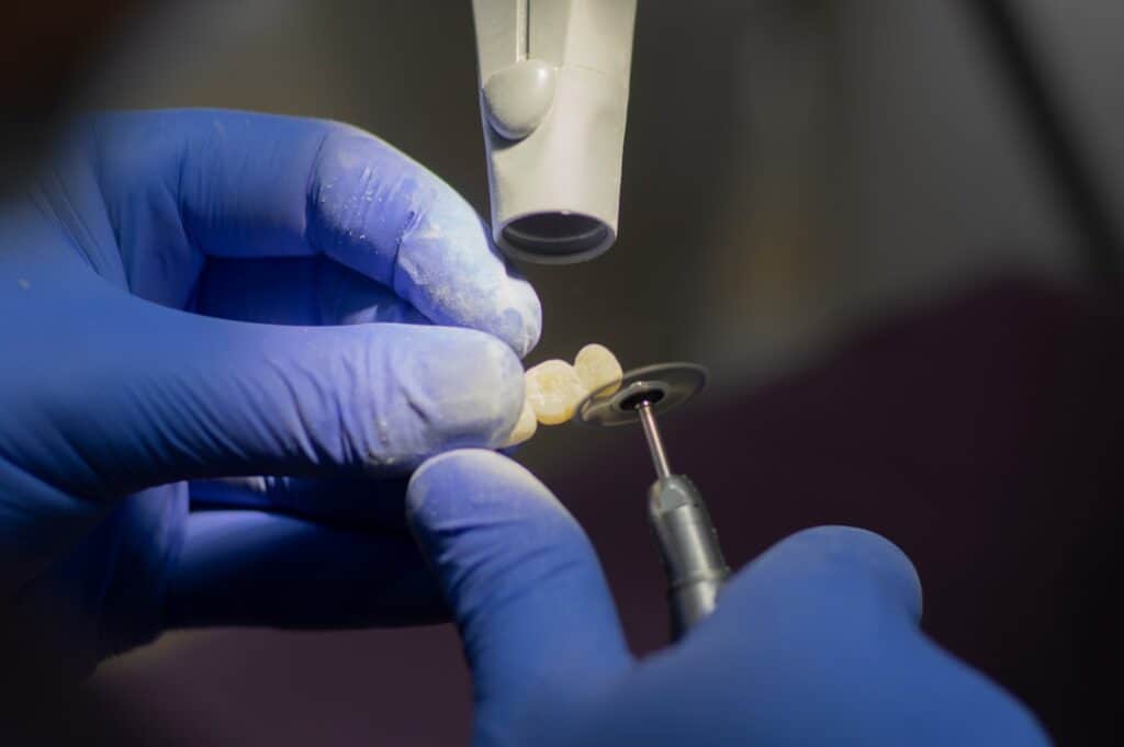 Customised Dental Solutions: Crowns, Aligners, and Implants Romford