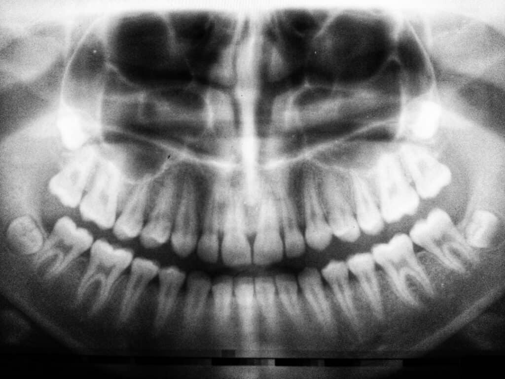The Future of 3D Printing in Oral Healthcare Romford