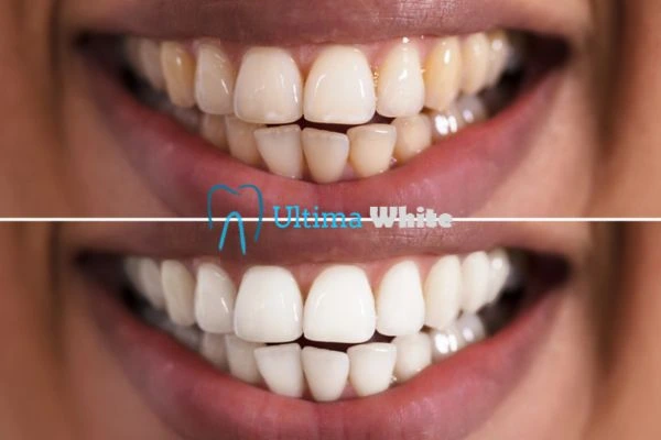 Long lasting results from Ultima White Romford